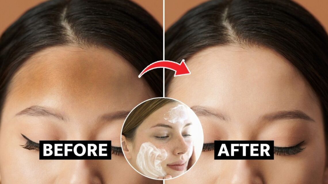 How to Remove Forehead Tan